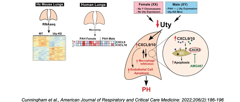 Diagram showing how Y-Chromosome gene, Uty, protects against pulmonary hypertension by reducing proinflammatory chemokines