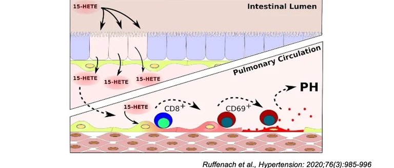 Diagram with arrows showing how oral 15-HETE induces pulmonary hypertension in mice by triggering T-cell dependent endothelial cell apoptosis